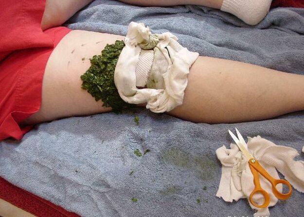Une compresse chaude de purée de feuilles de chou sur une articulation douloureuse du genou souffrant d'arthrose